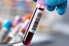 Screening tests can help assessing the health of postmenopausal women 