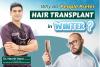 Why Winter Is Considered the Best Season for Hair Transplant : Hair Transplant Surgeon Dr. Navnit Haror Explains