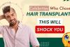 Celebrity Hair Transplant: You’d Never Guess They Had a Hair Transplant- But They Did