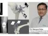 Augmented Reality (AR) Assisted Double Total Knee Replacements performed in Bangalore