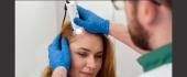 Questions to Ask Before Visiting a Hair Clinic