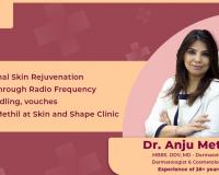 Exceptional Skin Rejuvenation Results through Radio Frequency Microneedling, vouches Dr. Anju Methil, Skin and Shape Clinic
