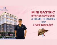 Mini Gastric Bypass Surgery: A Game-Changer for Liver Disease?