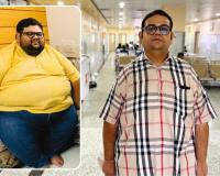 NOBESITY Surgery Helps Ahmedabad Resident Lose 109 Kg, Transforming Health and Life