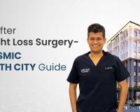 Life After Weight Loss Surgery – Ckosmic Health City Guide