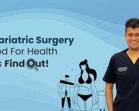 Is Bariatric Surgery Good For Health – Let’s Find Out