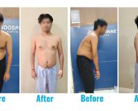 A 31-year-old who lived on a chair… until his spine finally said, ‘Enough’