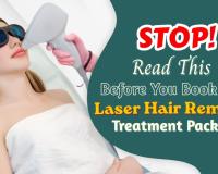 Thinking of Laser Hair Removal? Read This Before You Book Your Treatment Package