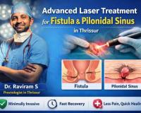 Advanced Laser Treatment for Fistula & Pilonidal Sinus in Thrissur – Dr. Raviram S