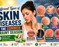 Different types of skin diseases in the Summer and Rainy Season
