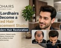 Why Lordhairs Has Become a Trusted Hair Replacement Studio for Modern Hair Restoration