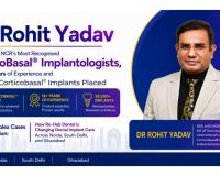 Dr. Rohit Yadav — Among Delhi NCR’s Most Recognised Corticobasal® Implantologists, with 14+ Years of Experience and 25,000+ Corticobasal® Implants Placed