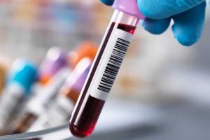 Screening tests can help assessing the health of postmenopausal women 