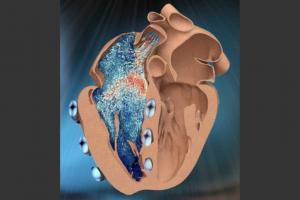 Indian-origin MIT engineer designs robotic replica of heart’s right chamber