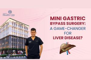 Mini Gastric Bypass Surgery: A Game-Changer for Liver Disease?