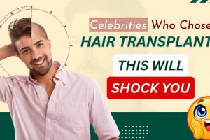 Celebrity Hair Transplant: You’d Never Guess They Had a Hair Transplant- But They Did
