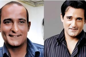 The Secret Behind Bollywood’s Perfect Hair? Why Hair Patches Are Becoming the Go-To Solution