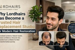 Why Lordhairs Has Become a Trusted Hair Replacement Studio for Modern Hair Restoration
