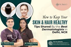 How to Keep Your Skin and Hair Healthy: Tips Shared By the Best Dermatologists in Delhi NCR